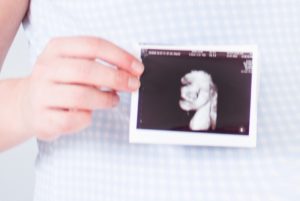 Rozhodování o potratu: Nic není černobílé